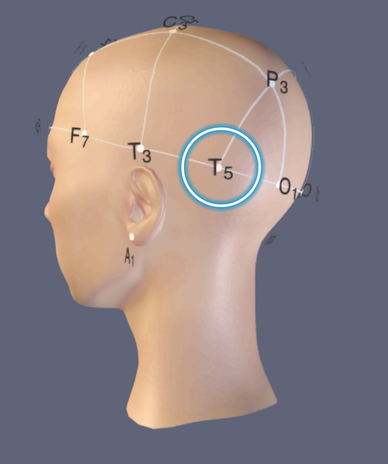 T5 Location