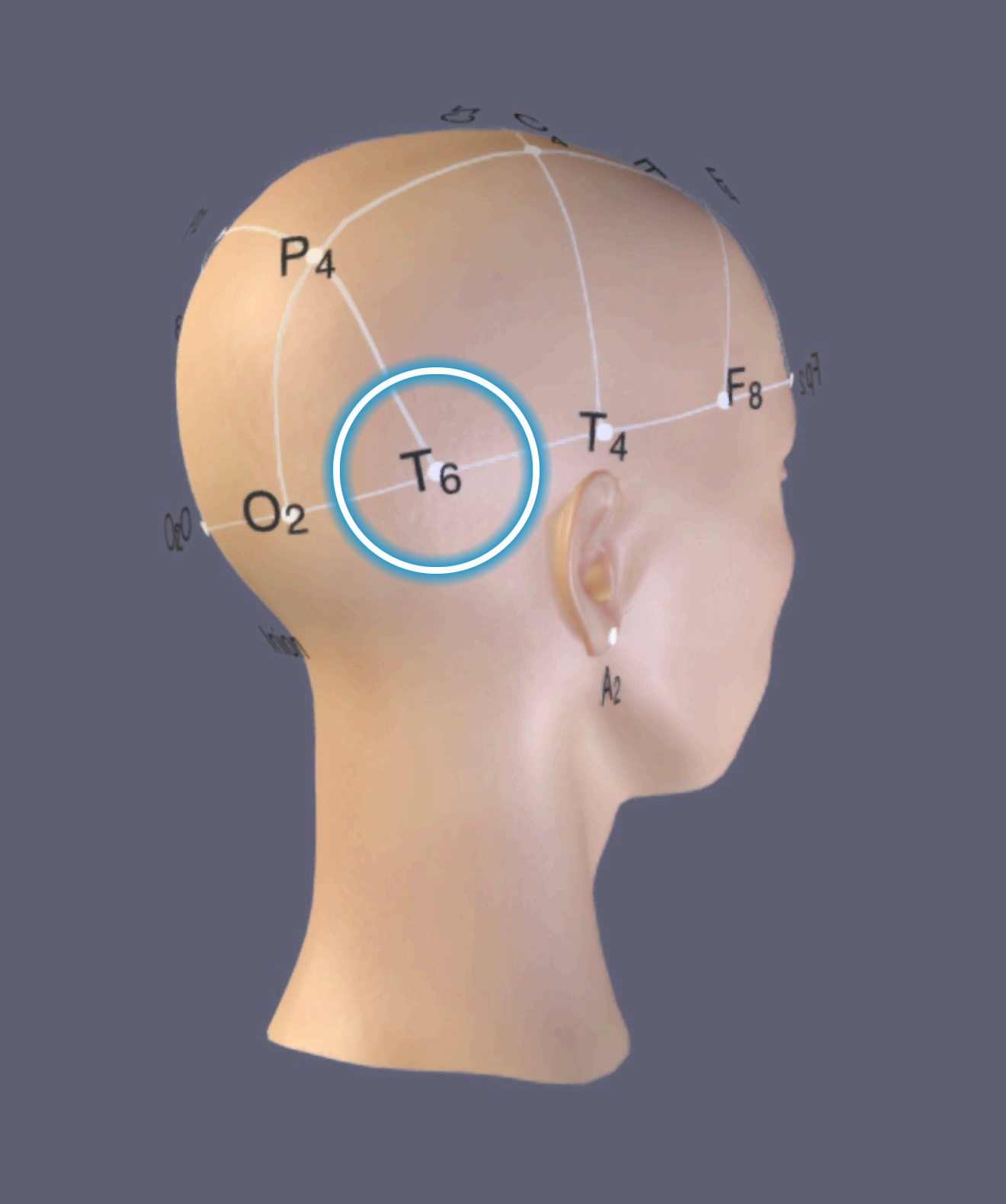 T6 Location