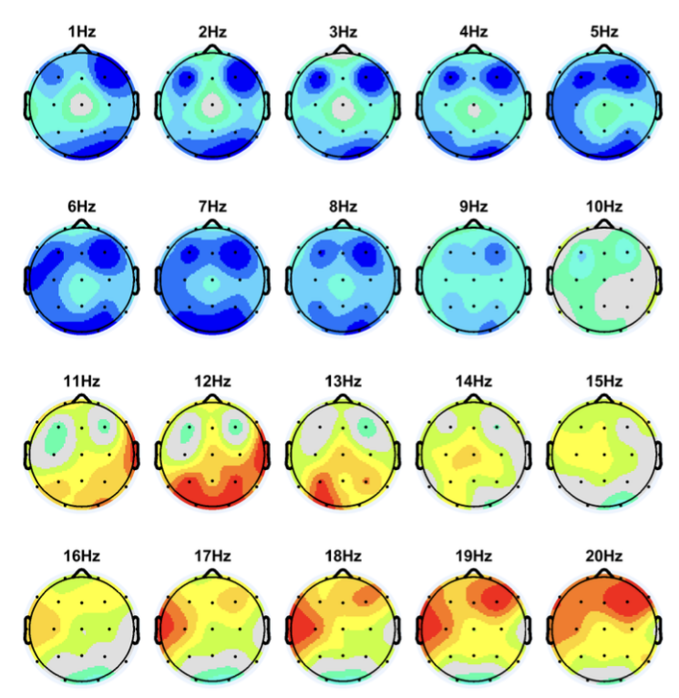 qeeg-brain-mapping